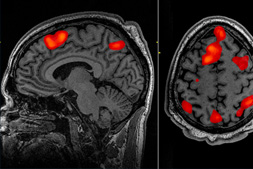 Brain Scanners Allow Scientists to ‘Read Minds’ – Could They Enable a ‘Big Brother’ Future?