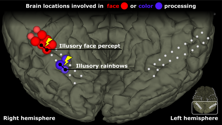 Figure 1: This figure shows the location of the electrodes on ventral areas of the patient’s cortex. Some electrodes are colored red to indicate that they showed a preferential response to faces over other objects. Other electrodes, in blue, were more active for color stimuli than grayscale stimuli. The remaining (white) electrodes did not show a strong preference for color or faces. The yellow lightning symbols with black lines between electrodes reflect electrode pairs that were stimulated, producing illusory face or color percepts.