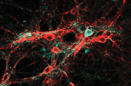 Researchers gain better understanding of how graphene interacts with brain cells to increase neuron 