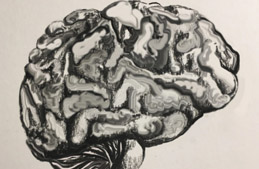 Researchers Design New Brain Implant