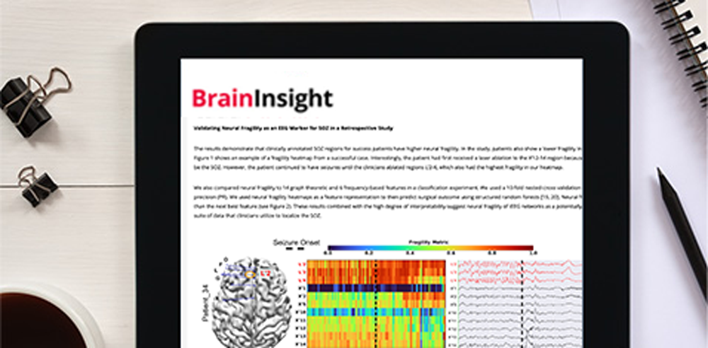 Brain Insight Newsletter